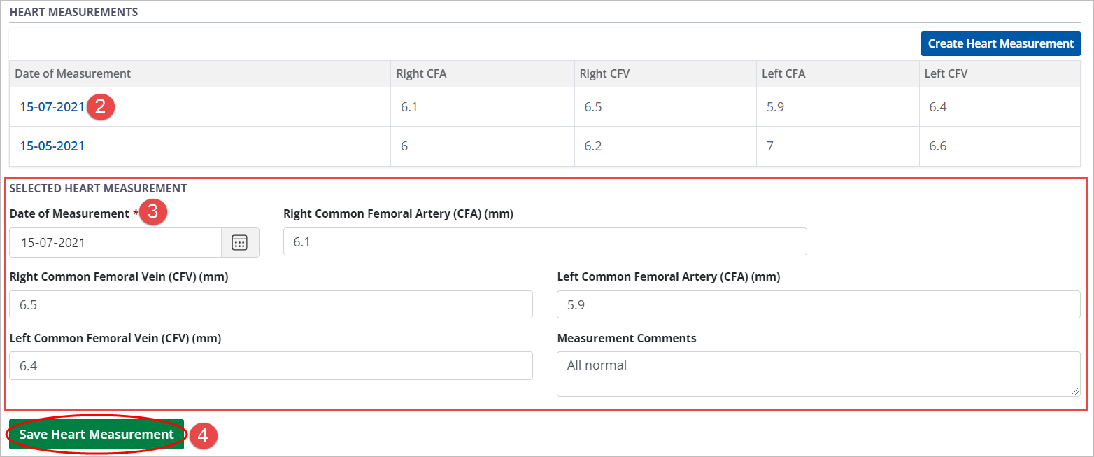 Example - Heart Measurement table and form, populated