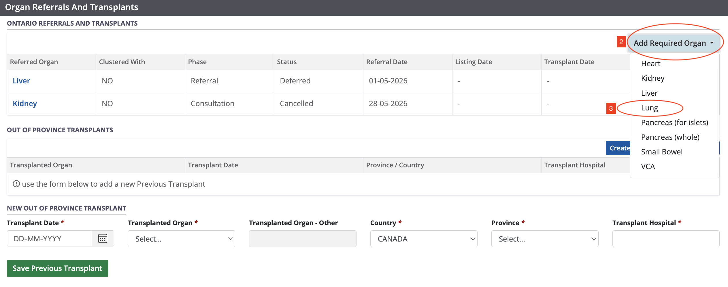 Example - Organ referrals and transfers table, empty