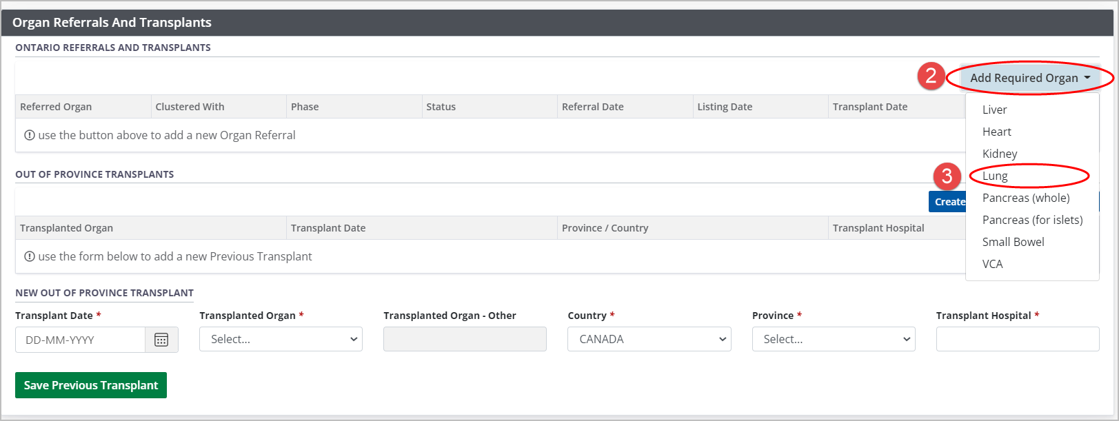 Example - Organ referrals and transfers table, empty