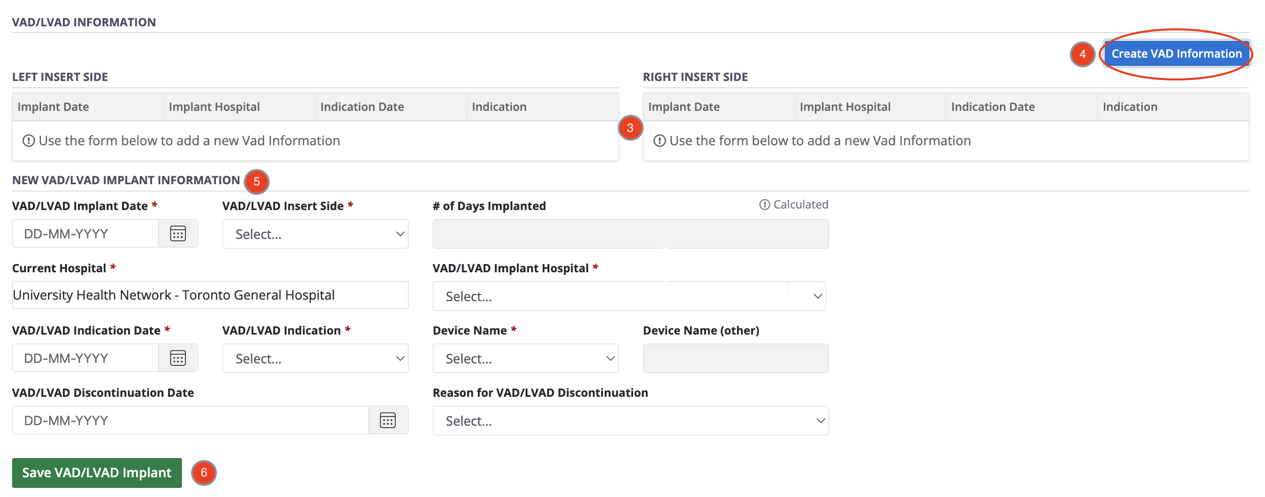 Example - VAD-LVAD form, empty